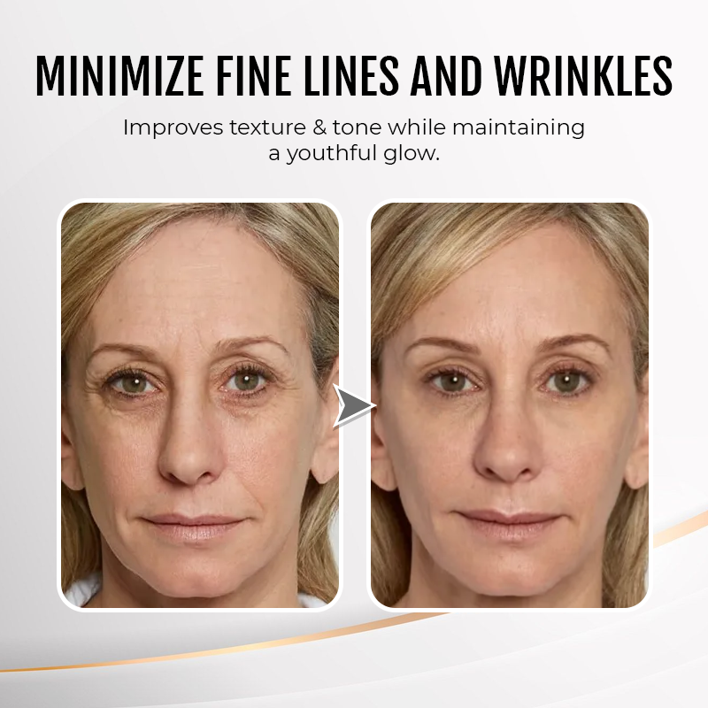 👨‍⚕️💐Made and Shipped from USA✨LIMETOW™ Instant Eye Cream Tightener😎LAST DAY 50%OFF
