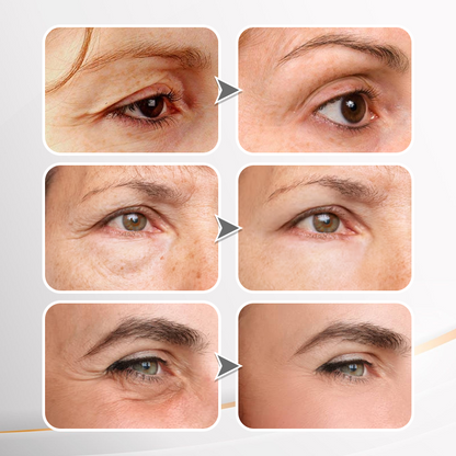 👨‍⚕️💐Made and Shipped from USA✨LIMETOW™ Instant Eye Cream Tightener😎LAST DAY 50%OFF