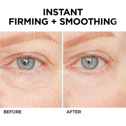 👨‍⚕️💐Made and Shipped from USA✨LIMETOW™ Instant Eye Cream Tightener😎LAST DAY 50%OFF