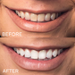 LIMETOW® Teeth Whitening Essence