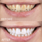 LIMETOW® Teeth Whitening Essence